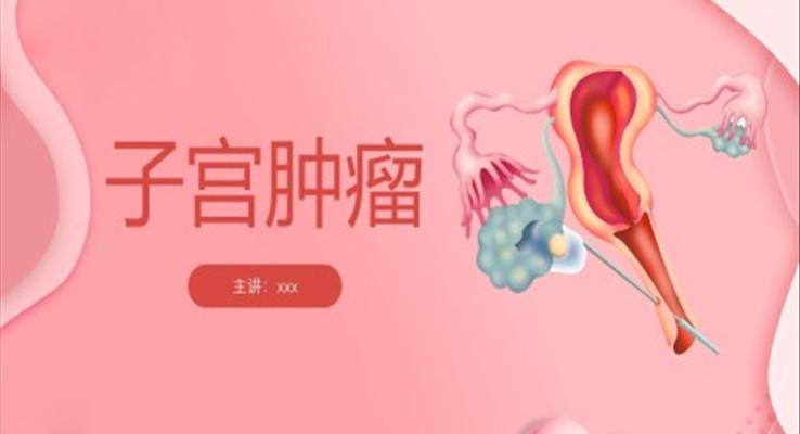 子宮腫瘤婦產(chǎn)科學(xué)課件ppt模板